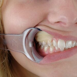 لوازم و مواد پریودنتال