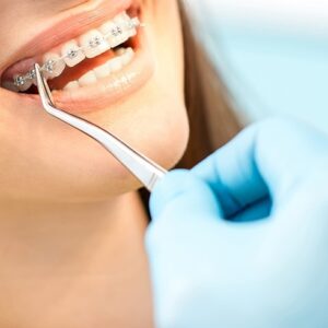 ابزار ارتودنسی