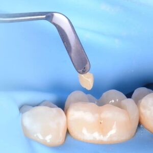 ابزار ترمیمی