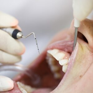 ابزار پریو و جراحی