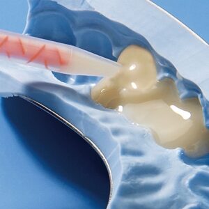 ماده روکش موقت